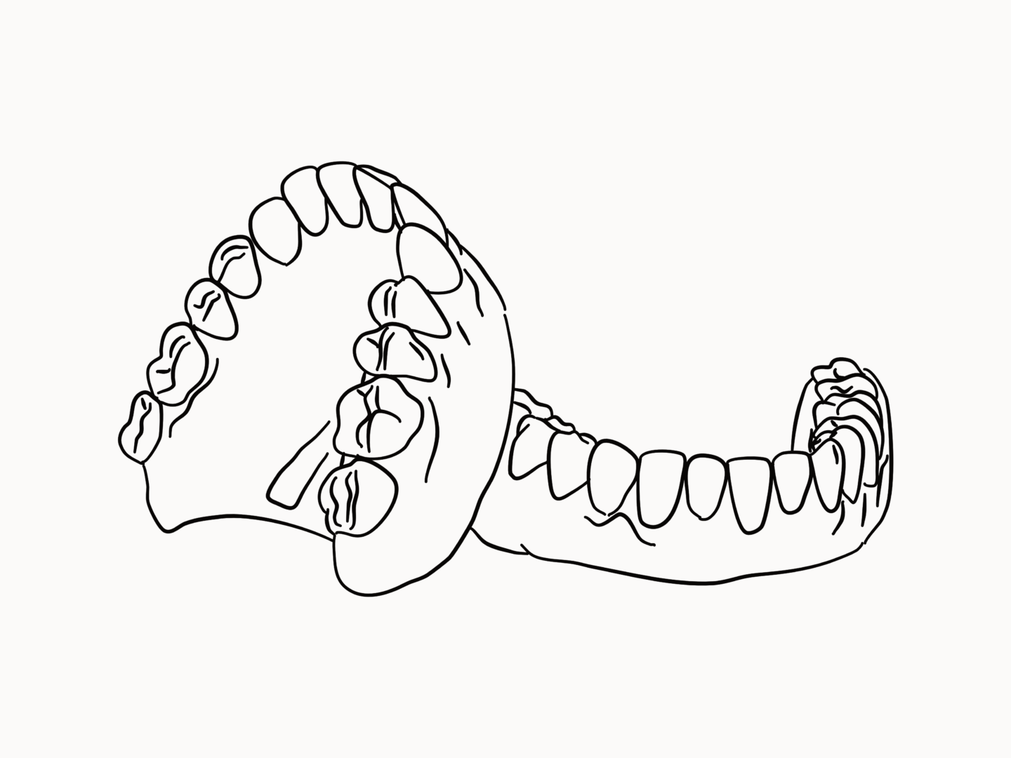 Dentures illustration